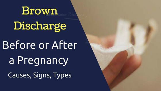 Brown Discharge Before Or After A Period Reasons Signs Types