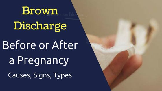 5-days-late-brown-discharge-before-period-mumsnet